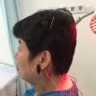 Tinnitus (ringing in the ear)